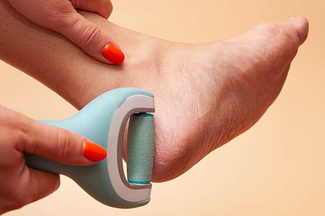 Best Callus Remover