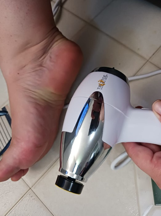 Tip2toe professional electric callus remover