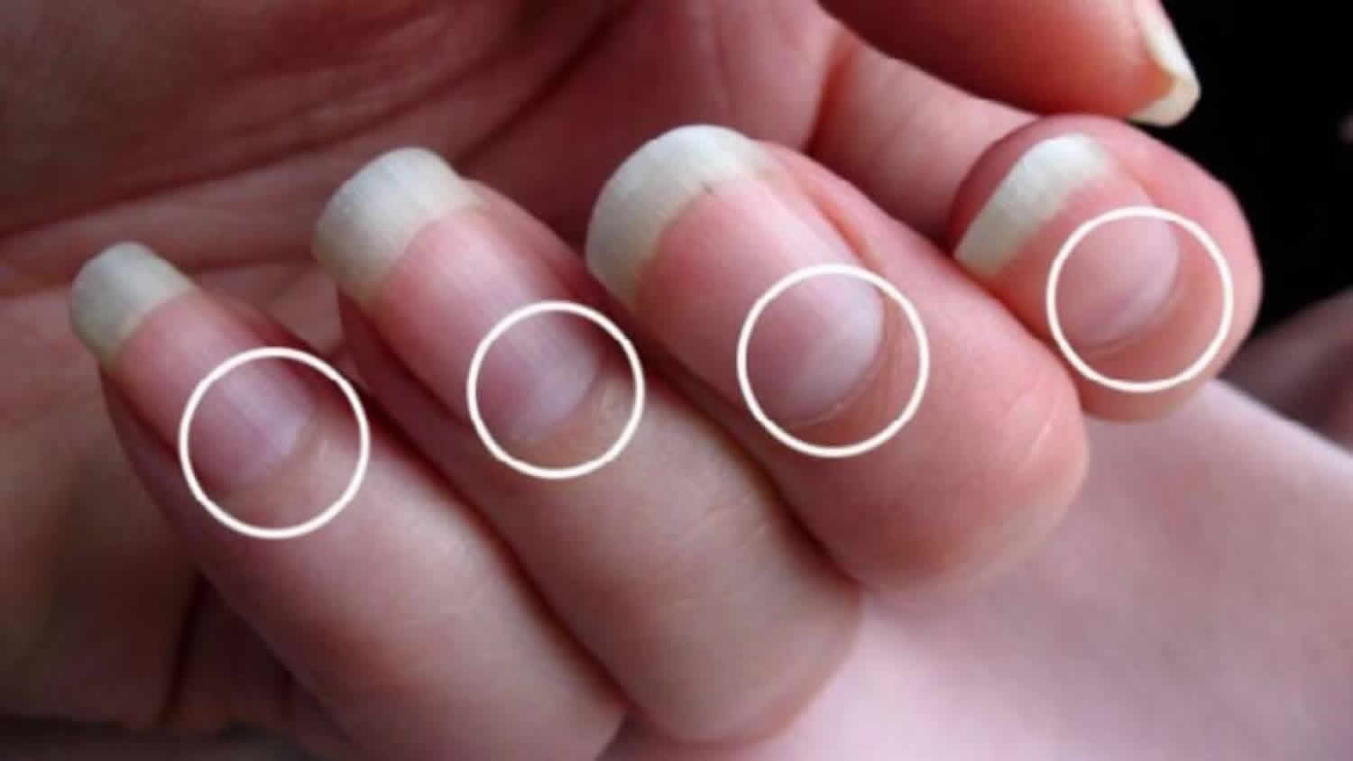 lunula of nail anatomy of nail