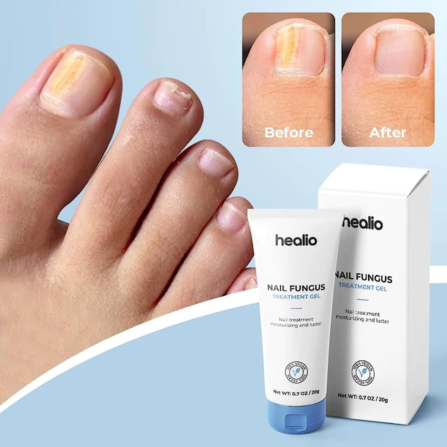 healio nail fungus