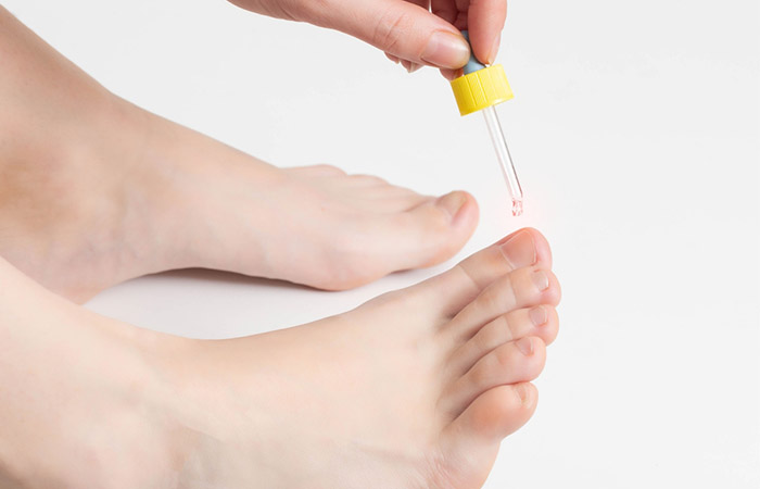 tea tree oil for toenail fungus