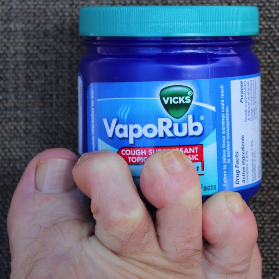 vicks vaporub for toenail fungus
