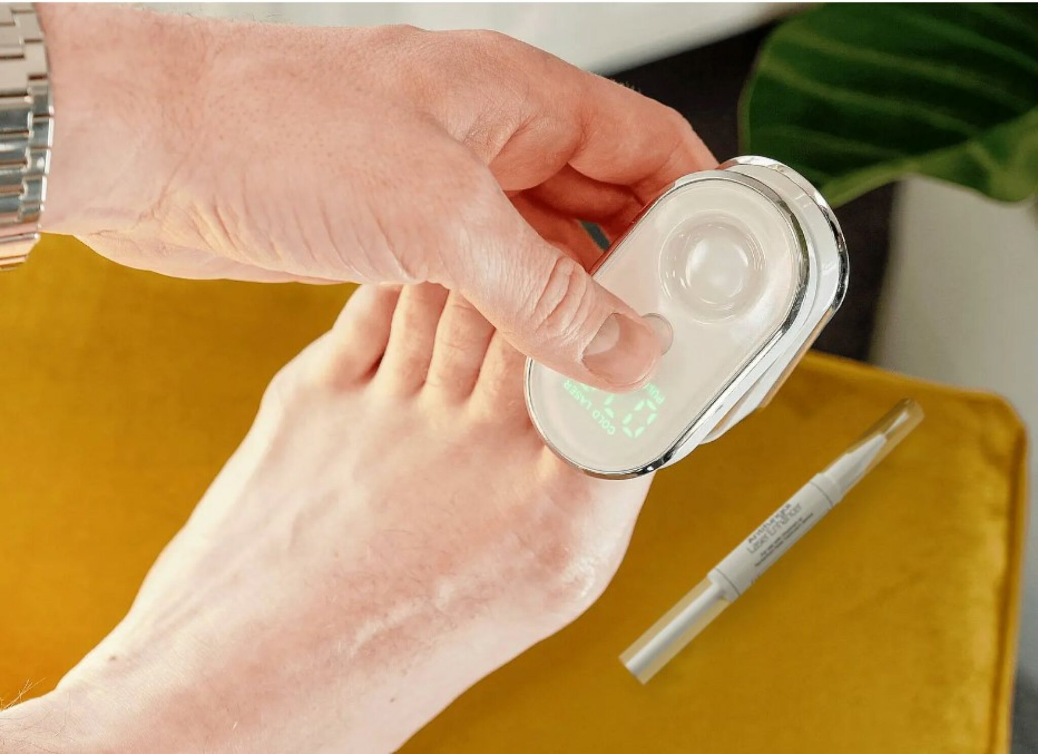 Onychom Laser by Dermachom Nail Fungus Treatment Review Why It May Not