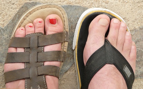 Wear-Sandals-with-Toenail-Fungus