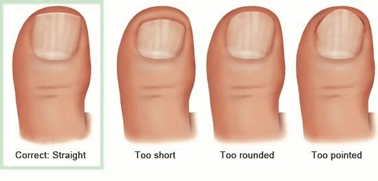 correct-nail-trimming