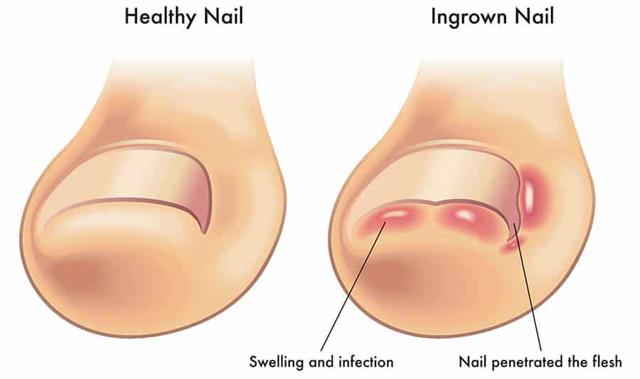 how-to-cut-your-toenails