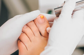 Is Laser Treatment for Toenail Fungus Really the Cure? Find Out Pros and Cons
