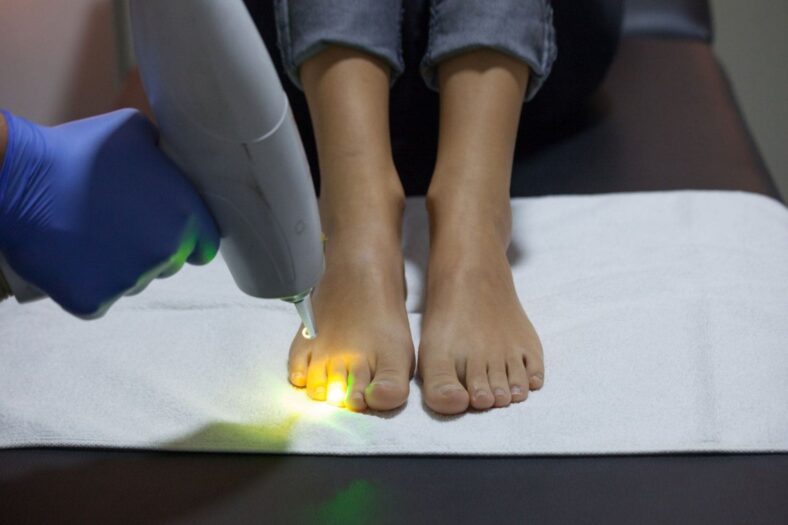 Toenail laser treatment near me
