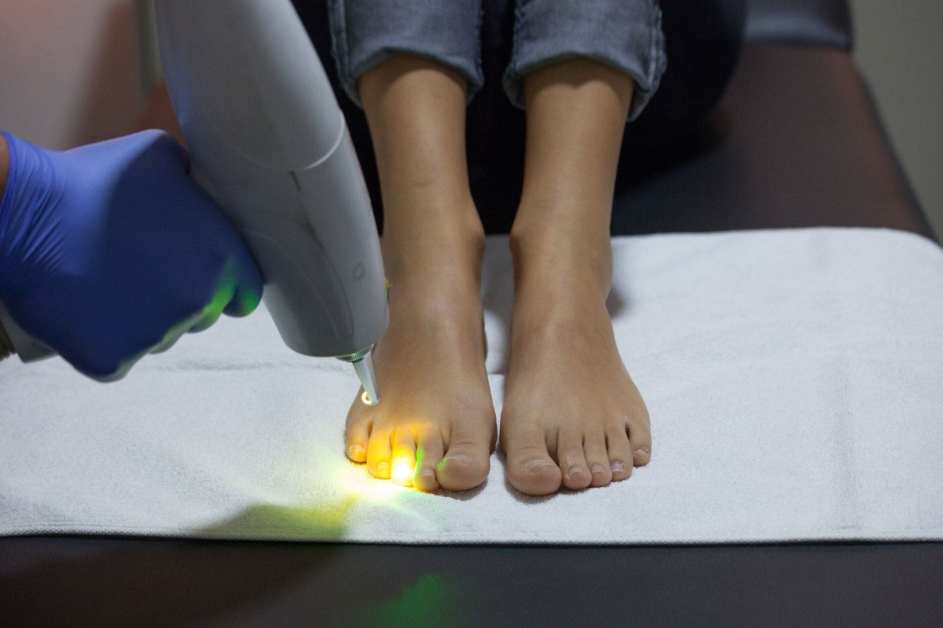  pros-and-cons-of-laser-treatment-for-toenail-fungus
