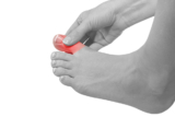 Will an ingrown toenail grow out on its own?