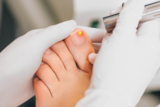 Is Laser Treatment for Toenail Fungus Really the Cure? Find Out Pros and Cons
