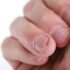 Anatomy Of Nails: An Inside Look Beyond the Polish