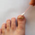 Home Remedies for Toenail Fungus
